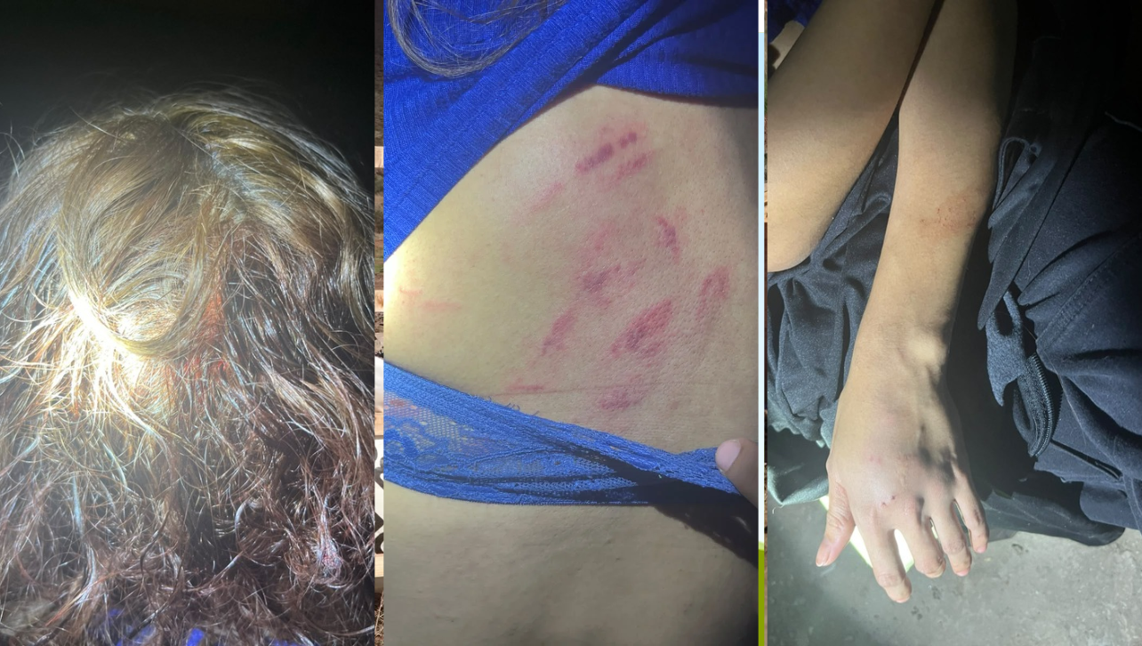 Detienen a hombre por intento de feminicidio en Mexicali